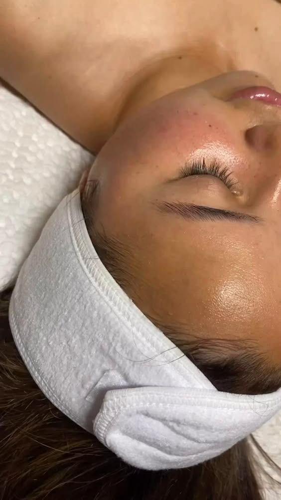 Hydrafacial